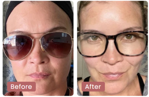 Before and after